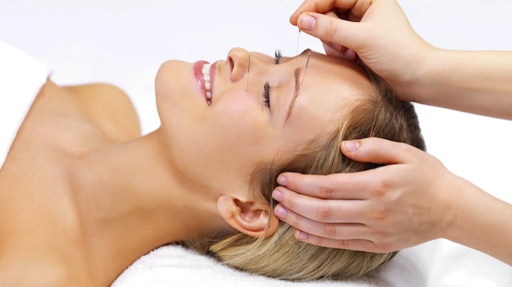 Acne Acupuncture treatment in Beverly Hills