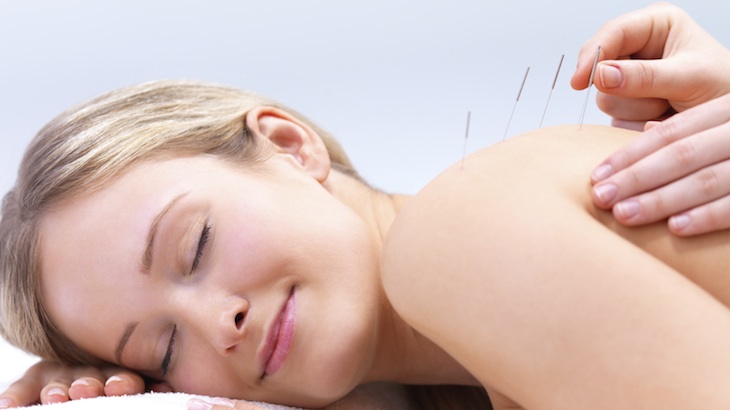 1 Hour Acupuncture or Cupping Session + A 15-Minute Consultation