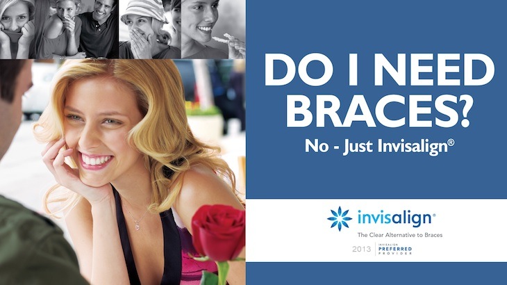 Full Invisalign Treatment with All Necessary Appointments